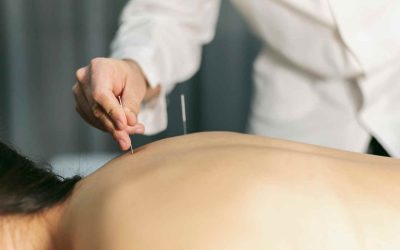 Unlocking Wellness with Acupuncture’s Short-Term and Long-Term Perks